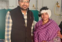 Photo of केजीएमयू के ईएनटी विभाग में कॉक्लियर इम्प्लांट सर्जरी मूक बधिर बच्चों के लिए साबित हो रही है वरदान